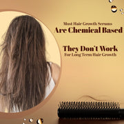 Zandu Hair Growth Serum (200ml) Clinically Proven to Promote Growth & Reduce Fall in 28 days